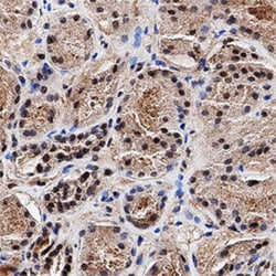 MGMT Antibody (MT 23.2) - BSA Free, Novus Biologicals:Antibodies:Primary
