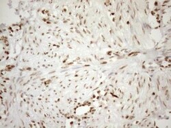 MGMT Antibody (OTI4F9), Novus Biologicals 0.1 mL | Buy Online | R&D Systems | Fisher Scientific