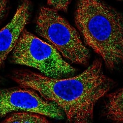 MIA3 Antibody, Novus Biologicals 0.1mL; Unlabeled:Antibodies, Polyclonal