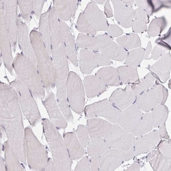 MIA3 Antibody, Novus Biologicals 0.1mL; Unlabeled:Antibodies, Polyclonal
