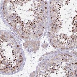 MIA3 Antibody, Novus Biologicals 0.1mL; Unlabeled:Antibodies, Polyclonal