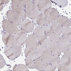 MIA3 Antibody, Novus Biologicals 25 &mu;L, Unlabeled:Antibodies, Polyclonal