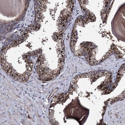 MICALCL Antibody, Novus Biologicals:Antibodies:Primary Antibodies