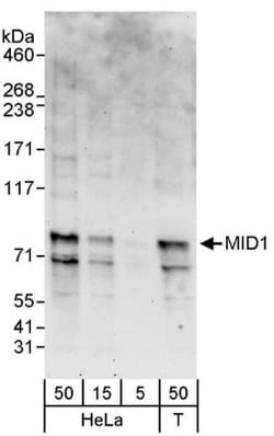 MID1 Antibody, Novus Biologicals 0.1mg; Unlabeled:Antibodies, Polyclonal