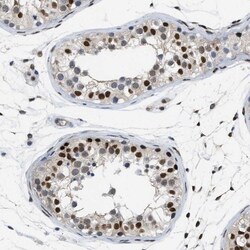 MIER1 Antibody, Novus Biologicals 0.1mL; Unlabeled:Antibodies, Polyclonal