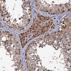 MIER2 Antibody, Novus Biologicals 25 &mu;L; Unlabeled:Antibodies, Polyclonal