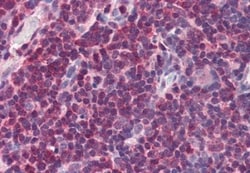 MIF Antibody, Novus Biologicals 0.1mg; Unlabeled:Antibodies, Polyclonal