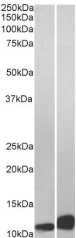 MIF Antibody, Novus Biologicals 0.1mg; Unlabeled:Antibodies, Polyclonal