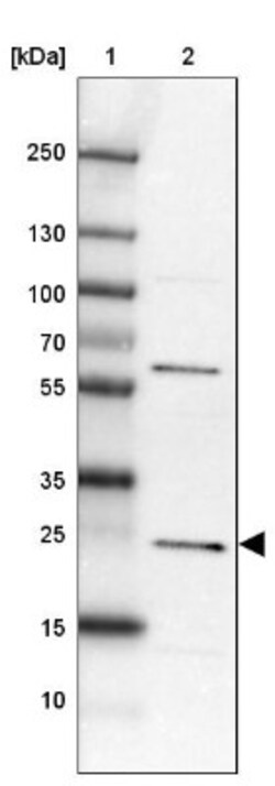 MIF4GD Antibody, Novus Biologicals 25 &mu;L, Unlabeled:Antibodies, Polyclonal