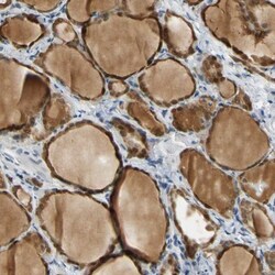 MINA Antibody, Novus Biologicals:Antibodies:Primary Antibodies