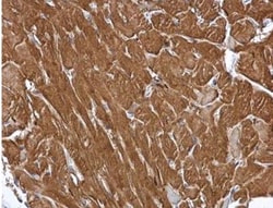 MINPP1 Antibody, Novus Biologicals 0.1mg; Unlabeled:Antibodies, Polyclonal