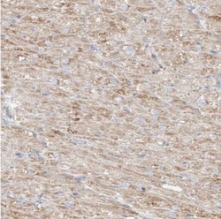 MIPEP Antibody, Novus Biologicals 0.1mL; Unlabeled:Antibodies, Polyclonal
