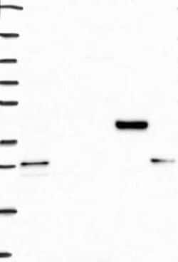 MIR16 Rabbit anti-Human, Polyclonal, Novus Biologicals 25 &mu;g; Unconjugated:Antibodies,