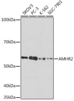 MIS RII/AMHR2 Rabbit anti-Human, Clone: 8Z8X4, Novus Biologicals 100 &mu;g;