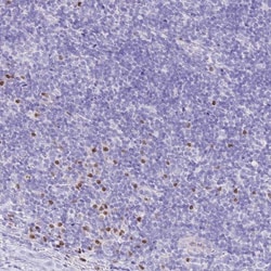 MIST1 Antibody, Novus Biologicals 0.1mL; Unlabeled:Antibodies, Polyclonal