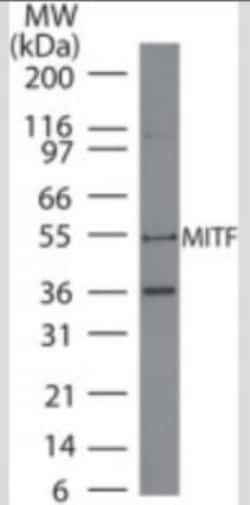 MITF Antibody (21D1418) - BSA Free, Novus Biologicals 0.1mg; Unlabeled:Antibodies,