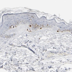 MITF Antibody, Novus Biologicals 25 &mu;L; Unlabeled:Antibodies, Polyclonal