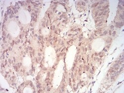 MKK3/MEK3 Antibody (2E12D11) - BSA Free, Novus Biologicals 0.1mg; Unlabeled:Antibodies,