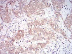 MKK3/MEK3 Antibody (2E12D11) - BSA Free, Novus Biologicals 0.1mg; Unlabeled:Antibodies,