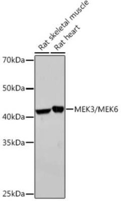 MKK3/MKK6 Rabbit anti-Human, Mouse, Rat, Clone: 8R1J5, Novus Biologicals 100 &mu;g | Buy Online | Novus Biologicals | Fisher Scientific