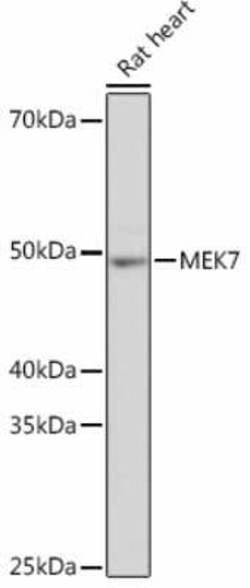 MKK7/MEK7 Rabbit anti-Human, Mouse, Rat, Clone: 1T3M6, Novus Biologicals:Antibodies:Primary