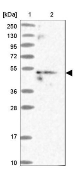 MKKS Antibody, Novus Biologicals 0.1mL; Unlabeled:Antibodies, Polyclonal