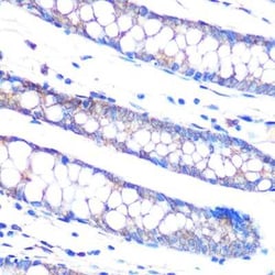 MKP-3/DUSP6 Rabbit anti-Human, Mouse, Rat, Clone: 1V5L10, Novus Biologicals