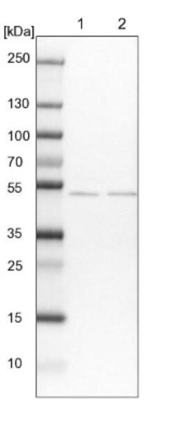 MKRN2 Antibody, Novus Biologicals 0.1mL; Unlabeled:Antibodies, Polyclonal