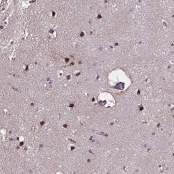 MLC1 Antibody, Novus Biologicals:Antibodies:Primary Antibodies