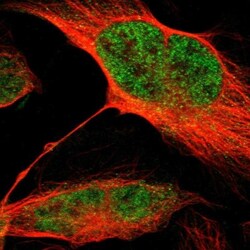 MLF2 Antibody, Novus Biologicals:Antibodies:Primary Antibodies