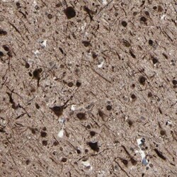 MLF2 Antibody, Novus Biologicals:Antibodies:Primary Antibodies