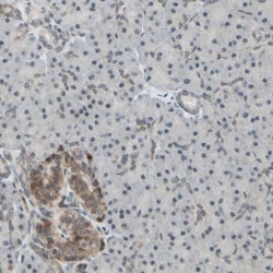 MLF2 Antibody, Novus Biologicals:Antibodies:Primary Antibodies