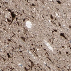 MLF2 Antibody, Novus Biologicals 0.1mL; Unlabeled:Antibodies, Polyclonal