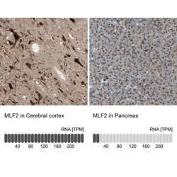 MLF2 Antibody, Novus Biologicals 0.1mL; Unlabeled:Antibodies, Polyclonal