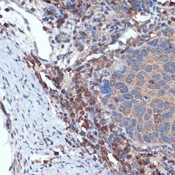 MLKL Rabbit anti-Human, Mouse, Rat, Clone: 7L1P5, Novus Biologicals:Antibodies:Primary