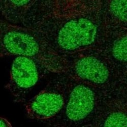 MLL5 Rabbit anti-Human, Polyclonal, Novus Biologicals 100 &mu;g | Buy Online | Bio-Techne | Fisher Scientific