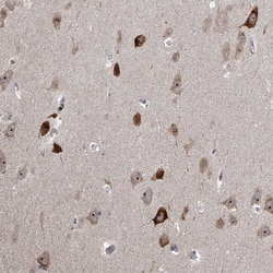 MLLT1 Antibody, Novus Biologicals:Antibodies:Primary Antibodies
