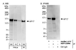 MLLT6 Antibody, Novus Biologicals 0.1mg; Unlabeled:Antibodies, Polyclonal