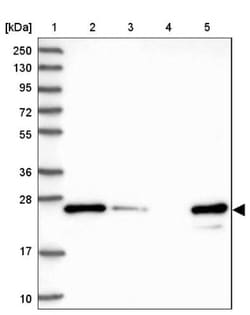 FTSJ1 Antibody, Novus Biologicals:Antibodies:Primary Antibodies