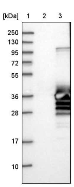 Caldesmon/CALD1 Antibody, Novus Biologicals:Antibodies:Primary Antibodies