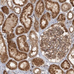 MMADHC Antibody, Novus Biologicals:Antibodies:Primary Antibodies