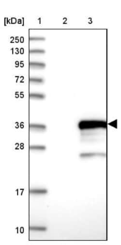 MMADHC Antibody, Novus Biologicals:Antibodies:Primary Antibodies