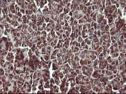 MMP-13 Antibody (OTI2D8), Novus Biologicals 0.1mL; Unlabeled:Antibodies,