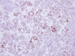 MMP-13 Antibody, Novus Biologicals 0.1mL; Unlabeled:Antibodies, Polyclonal
