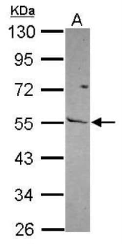 MMP-13 Antibody, Novus Biologicals 0.1mL; Unlabeled:Antibodies, Polyclonal