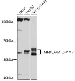 MMP-14/MT1-MMP Rabbit anti-Human, Mouse, Rat, Clone: 6T7L3, Novus Biologicals:Antibodies:Primary