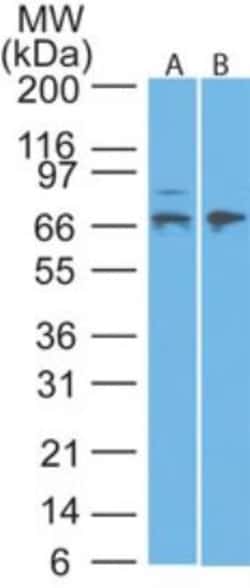 MMP-2 Antibody, Novus Biologicals 0.025mg; Unlabeled:Antibodies, Polyclonal