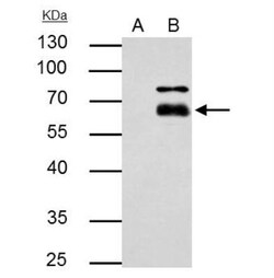 MMP-8 Antibody, Novus Biologicals 0.1mL; Unlabeled:Antibodies, Polyclonal