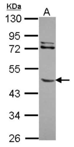 MMP-8 Antibody, Novus Biologicals 0.1mL; Unlabeled:Antibodies, Polyclonal