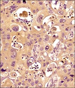 MMP-9 Antibody (4A3), Novus Biologicals:Antibodies:Primary Antibodies